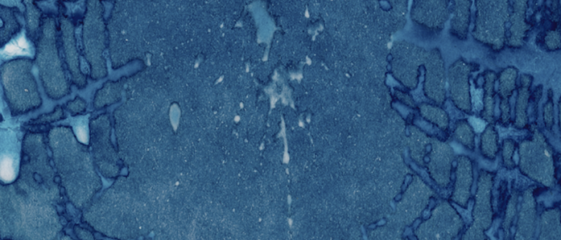 A textured blue image that resembles rippling water or a spider web.